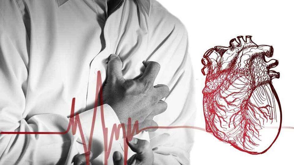 Կրծքավանդակի օստեոխոնդրոզում սրտի ռիթմի խանգարման պատճառով կարող է զարգանալ էքստրասիստոլա