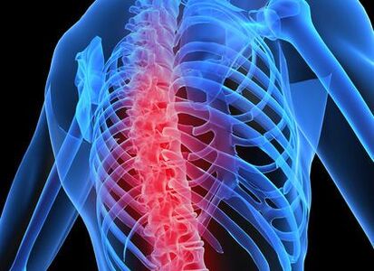 կրծքային ողնաշարի օստեոխոնդրոզ